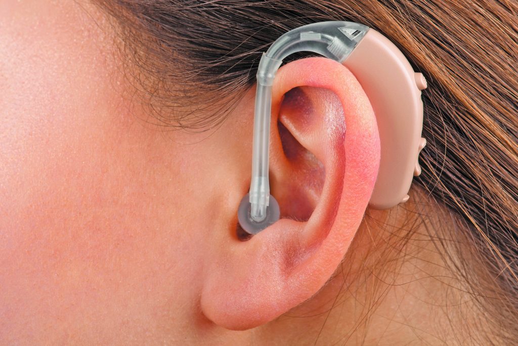 You are currently viewing FDA Clears Path for Hearing Aids to Be Sold Over the Counter